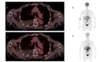 Single- and dual-tracer PET/CT